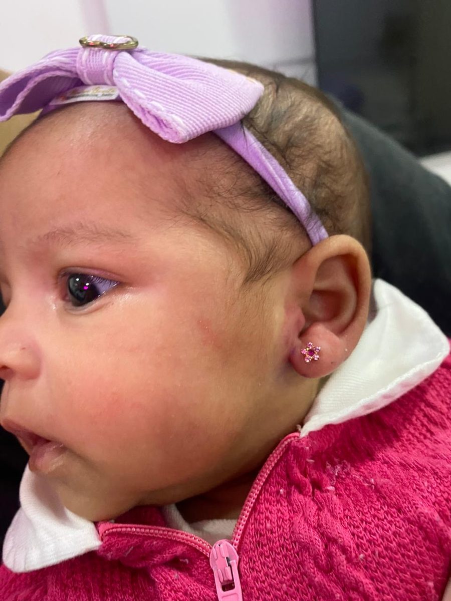 Bebê usando brinco rosa após atendimento na Luquini Clinic, Rio de Janeiro